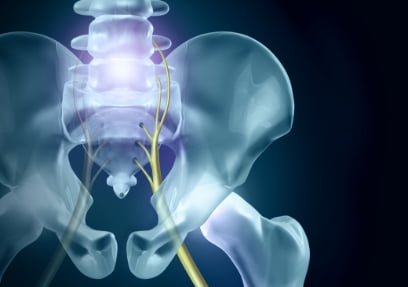 MicroTube Spine Surgery - Lumbar Radiculopathy